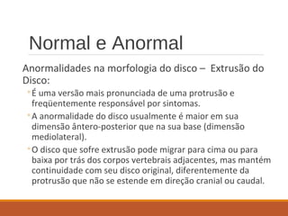 Normal e Anormal
Anormalidades na morfologia do disco – Extrusão do
Disco:
◦É uma versão mais pronunciada de uma protrusão e
freqüentemente responsável por sintomas.
◦A anormalidade do disco usualmente é maior em sua
dimensão ântero-posterior que na sua base (dimensão
mediolateral).
◦O disco que sofre extrusão pode migrar para cima ou para
baixa por trás dos corpos vertebrais adjacentes, mas mantém
continuidade com seu disco original, diferentemente da
protrusão que não se estende em direção cranial ou caudal.
 