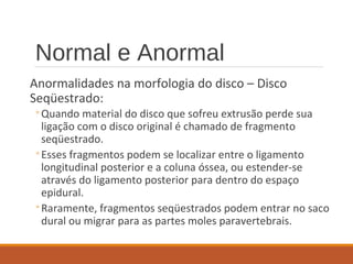 Normal e Anormal
Anormalidades na morfologia do disco – Disco
Seqüestrado:
◦Quando material do disco que sofreu extrusão perde sua
ligação com o disco original é chamado de fragmento
seqüestrado.
◦Esses fragmentos podem se localizar entre o ligamento
longitudinal posterior e a coluna óssea, ou estender-se
através do ligamento posterior para dentro do espaço
epidural.
◦Raramente, fragmentos seqüestrados podem entrar no saco
dural ou migrar para as partes moles paravertebrais.
 