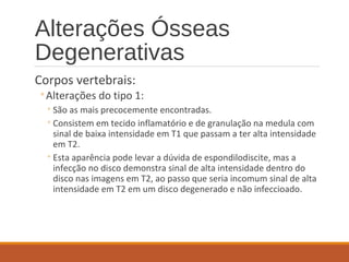 Alterações Ósseas
Degenerativas
Corpos vertebrais:
◦Alterações do tipo 1:
◦São as mais precocemente encontradas.
◦Consistem em tecido inflamatório e de granulação na medula com
sinal de baixa intensidade em T1 que passam a ter alta intensidade
em T2.
◦Esta aparência pode levar a dúvida de espondilodiscite, mas a
infecção no disco demonstra sinal de alta intensidade dentro do
disco nas imagens em T2, ao passo que seria incomum sinal de alta
intensidade em T2 em um disco degenerado e não infeccioado.
 