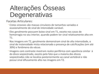 Alterações Ósseas
Degenerativas
Facetas Articulares:
◦Cistos sinoviais são massas circulares de tamanhos variados e
ocasionalmente de sinal de intensidade variável.
◦Eles geralmente possuem baixo sinal em T1, exceto nos casos de
hemorragia no seu interior, quando podem ter sinal relativamente alto em
T1.
◦Nas imagens em T2, geralmente demonstram sinal de alta intensidade, o
sinal de instensidade mista relacionado a presença de calcificações (em até
30%) e fenômeno do vácuo.
◦Imagens com contraste mostram realce periférico com aparência similar à
do disco seqüestrado, exceto pelo fato que a maioria dos discos
seqüestrados não se localiza posteriormente ao canal vertebral e não
possui sinal difusamente alto nas imagens em T2.
 