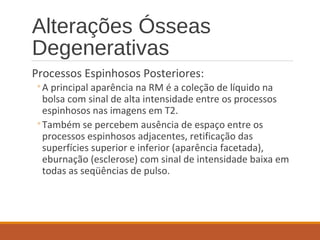 Alterações Ósseas
Degenerativas
Processos Espinhosos Posteriores:
◦A principal aparência na RM é a coleção de líquido na
bolsa com sinal de alta intensidade entre os processos
espinhosos nas imagens em T2.
◦Também se percebem ausência de espaço entre os
processos espinhosos adjacentes, retificação das
superfícies superior e inferior (aparência facetada),
eburnação (esclerose) com sinal de intensidade baixa em
todas as seqüências de pulso.
 