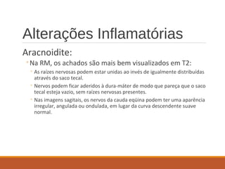 Alterações Inflamatórias
Aracnoidite:
◦Na RM, os achados são mais bem visualizados em T2:
◦ As raízes nervosas podem estar unidas ao invés de igualmente distribuídas
através do saco tecal.
◦ Nervos podem ficar aderidos à dura-máter de modo que pareça que o saco
tecal esteja vazio, sem raízes nervosas presentes.
◦ Nas imagens sagitais, os nervos da cauda eqüina podem ter uma aparência
irregular, angulada ou ondulada, em lugar da curva descendente suave
normal.
 