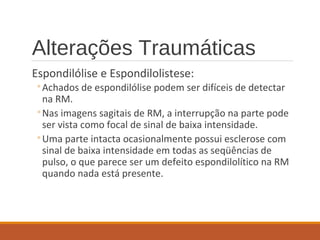 Alterações Traumáticas
Espondilólise e Espondilolistese:
◦Achados de espondilólise podem ser difíceis de detectar
na RM.
◦Nas imagens sagitais de RM, a interrupção na parte pode
ser vista como focal de sinal de baixa intensidade.
◦Uma parte intacta ocasionalmente possui esclerose com
sinal de baixa intensidade em todas as seqüências de
pulso, o que parece ser um defeito espondilolítico na RM
quando nada está presente.
 