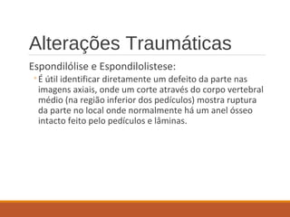 Alterações Traumáticas
Espondilólise e Espondilolistese:
◦É útil identificar diretamente um defeito da parte nas
imagens axiais, onde um corte através do corpo vertebral
médio (na região inferior dos pedículos) mostra ruptura
da parte no local onde normalmente há um anel ósseo
intacto feito pelo pedículos e lâminas.
 
