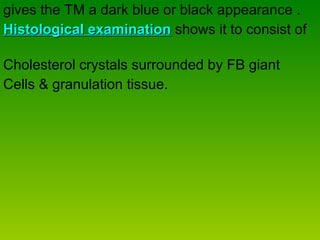 gives the TM a dark blue or black appearance .  Histological examination  shows it to consist of  Cholesterol crystals surrounded by FB giant  Cells & granulation tissue. 