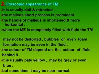 2. Otoscopic appearance of TM  : - it is usually dull & retracted . - the malleus short process is prominent . - the handle of malleus is shortened & more horizontal . - when the ME is completely filled with fluid the TM  may not be distorted , bubbles  or  even  foam  formation may be seen in the fluid . - the colour of TM depend on  the  colour  of  fluid  behind it . - it is usually pale yellow ,  may be grey or even  blue . - but some time it may be near normal. 