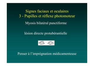 Signes faciaux et oculaires
3 - Pupilles et réflexe photomoteur
    Myosis bilatéral punctiforme

    lésion directe protubérantielle




Penser à l’imprégnation médicamenteuse
 