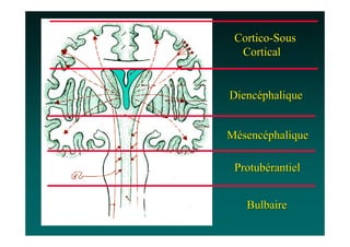 Cortico-Sous
  Cortical


Diencéphalique


Mésencéphalique

 Protubérantiel


   Bulbaire
 