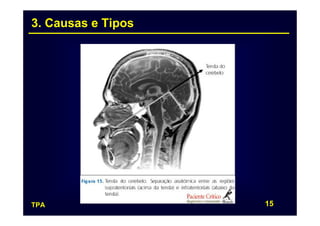 3. Causas e Tipos




TPA                 15
 
