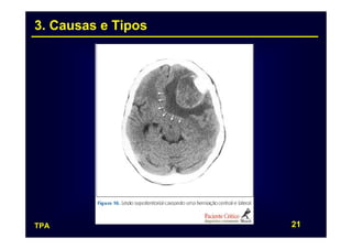 3. Causas e Tipos




TPA                 21
 