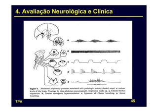 4. Avaliação Neurológica e Clínica




TPA                                  45
 
