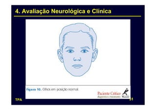 4. Avaliação Neurológica e Clínica




TPA                                  51
 
