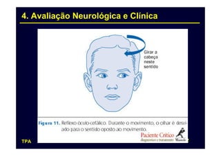 4. Avaliação Neurológica e Clínica




TPA                                  52
 