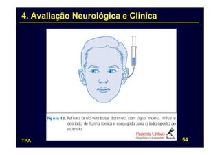 4. Avaliação Neurológica e Clínica




TPA                                  54
 