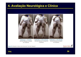 4. Avaliação Neurológica e Clínica




TPA                                  56
 