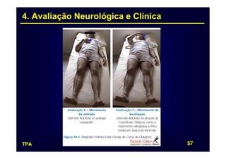 4. Avaliação Neurológica e Clínica




TPA                                  57
 