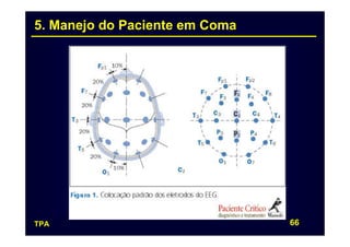 5. Manejo do Paciente em Coma




TPA                             66
 