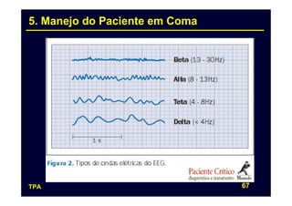 5. Manejo do Paciente em Coma




TPA                             67
 