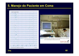 5. Manejo do Paciente em Coma




TPA                             68
 