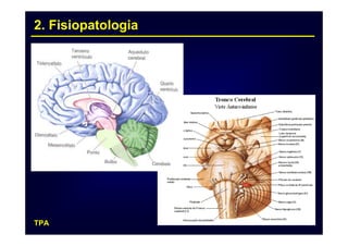 2. Fisiopatologia




TPA                 7
 