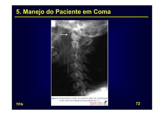5. Manejo do Paciente em Coma




TPA                             72
 