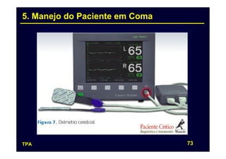 5. Manejo do Paciente em Coma




TPA                             73
 