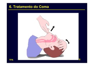 6. Tratamento do Coma




TPA                     76
 