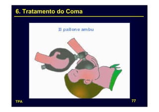 6. Tratamento do Coma




TPA                     77
 