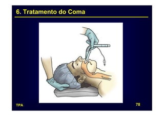 6. Tratamento do Coma




TPA                     78
 