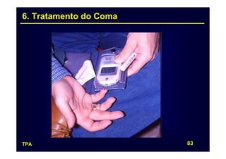 6. Tratamento do Coma




TPA                     83
 