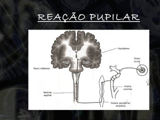 REAÇÃO PUPILAR 