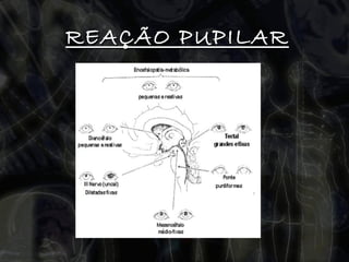 REAÇÃO PUPILAR 