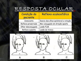 RESPOSTA OCULAR   Lesão de tronco Reflexo ausente Lesão FLM Olhar desconjugado Mov conjugado em direção oposta Reflexo preservado Desvio dos olhos ipsilateral a rotação Consciente Reflexo oculocefálico Condição do paciente 