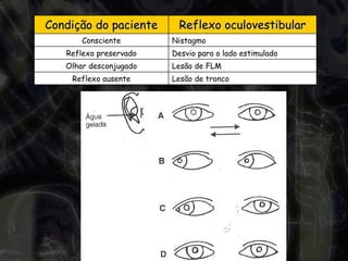Lesão de tronco Reflexo ausente Lesão de FLM Olhar desconjugado Desvio para o lado estimulado Reflexo preservado Nistagmo Consciente Reflexo oculovestibular Condição do paciente 