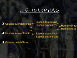 ...ETIOLOGIAS Causas supratentoriais Causas infratentoriais  Causas metabólicas Lesões destrutivas Lesões expansivas Lesões destrutivas Lesões expansivas Hérnia central  Hérnia lateral 