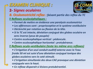 2- Signes oculaires
B. Oculomotricité reflex : faisant partie des reflex du TC
Reflexes oculocéphaliques :
• Permet de mettre en évidence une paralysie oculomotrice
• Les afférences sont : proprioceptive et le système vestibulaire
• Déclenché par rotation ou flexion de la tête.
• Si le TC est intacte, déviation conjugué des globes oculaire en
sens inverse (yeux de poupée)
• Centre oculocephalique vertical : pédoncule.
• Centre oculocephalique horizontal : protubérance.

Reflexes oculo-vestibulaire (teste les même arcs reflexes)
• L’irrigation d’un seul conduit auditif externe avec le l’eau
froide 50 ml est suivi d’une déviation conjugué tonique des
globes oculaires vers le coté stimulé.
• L’irrigation simultanée des deux CAE provoque une déviation
conjuguée vers le haut.
• Ce reflexe disparait si lésions protubérantiel.

 