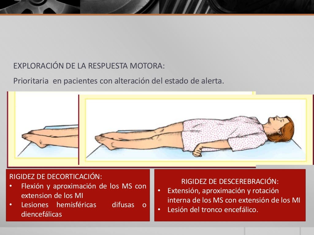 Coma, diagnóstico y tratamiento en urgencias Coma, diagnóstico y tratamiento en urgencias