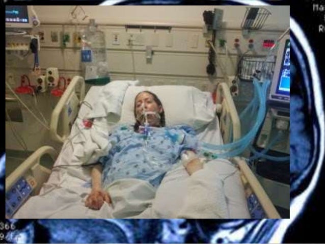 Coma Coma