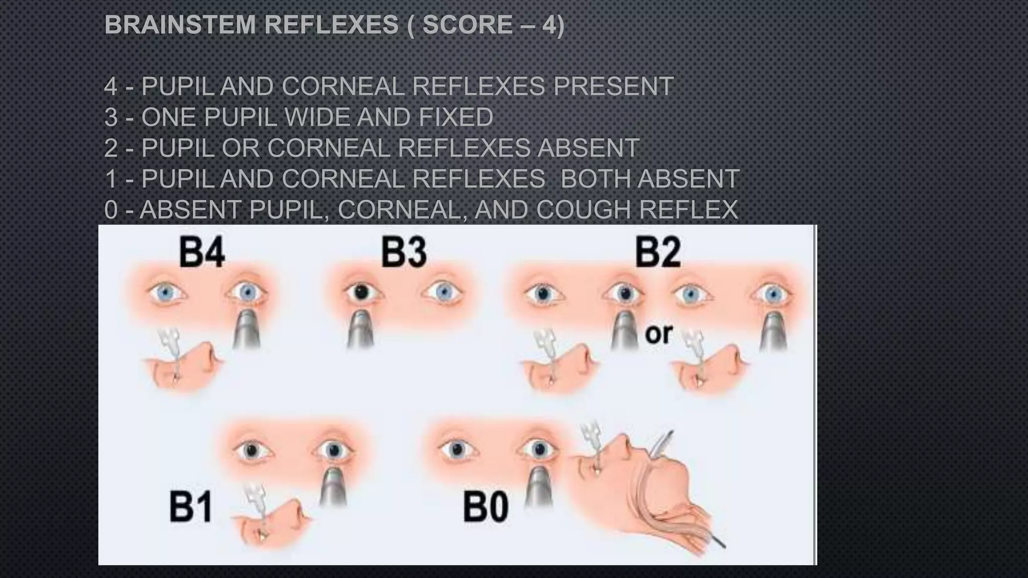 BRAINSTEM REFLEXES ( SCORE – 4)
4 - PUPIL AND CORNEAL REFLEXES PRESENT
3 - ONE PUPIL WIDE AND FIXED
2 - PUPIL OR CORNEAL REFLEXES ABSENT
1 - PUPIL AND CORNEAL REFLEXES BOTH ABSENT
0 - ABSENT PUPIL, CORNEAL, AND COUGH REFLEX