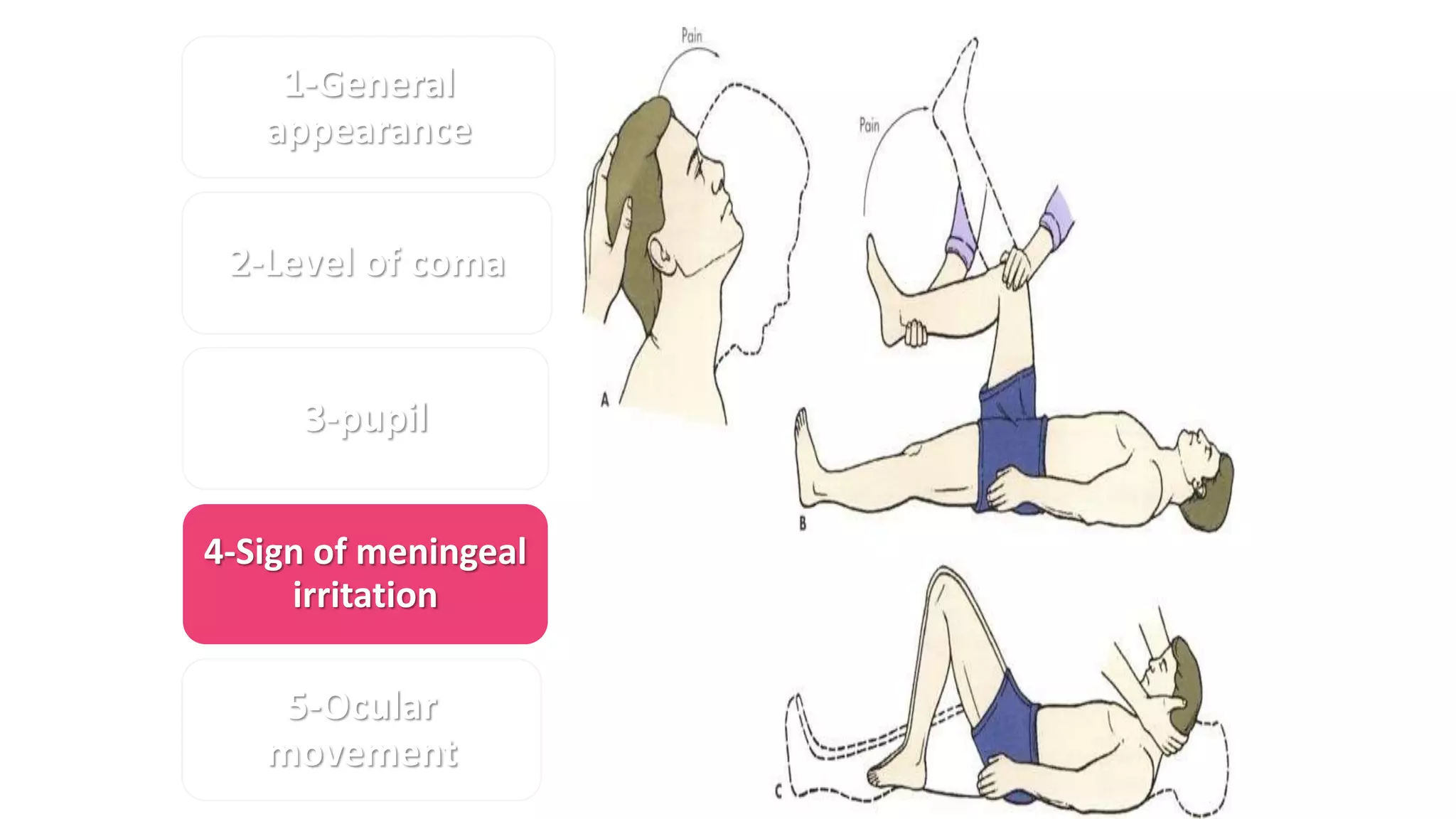1-General
appearance
2-Level of coma
3-pupil
4-Sign of meningeal
irritation
5-Ocular
movement
6-fundus
7-Corneal reflex
8-Gag reflex
9-respiration
10-Motor
response
 