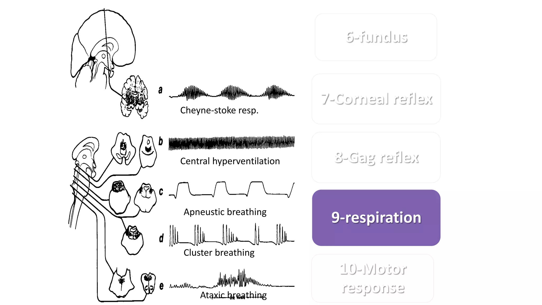 1-General
appearance
2-Level of coma
3-pupil
4-Sign of meningeal
irritation
5-Ocular
movement
6-fundus
7-Corneal reflex
8-Gag reflex
9-respiration
10-Motor
response
Cheyne-stoke resp.
Central hyperventilation
Apneustic breathing
Cluster breathing
Ataxic breathing
 