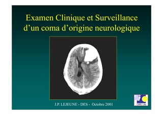 Examen Clinique et Surveillance
d’un coma d’origine neurologique
J.P. LEJEUNE - DES - Octobre 2001
 
