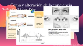 Coma y alteracion del estado de conciencia | PPTX