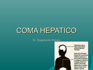COMA HEPATICO
   Dr. Dagoberto Molina
 