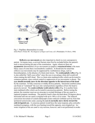 © Dr. Michael P. Merchut Page 3 11/14/2012
Fig. 1 Pupillary abnormalities in coma
(from Plum F, Posner JB. The Diagnosis of Stupor and Coma, ed 3, Philadelphia: FA Davis, 1980)
Reflexive eye movements are also important to check in every unresponsive
patient. In trauma cases, a cervical fracture must first be excluded before the patient's
neck is moved during this part of the examination. Again, whenever there are
asymmetric abnormalities of eye movements (or pupils) a structural lesion is the more
likely cause of coma than a toximetabolic condition. It should also be noted that
reflexive eye movements may be suppressed by vestibulotoxic drugs, such as
benzodiazepines, in the absence of a brain stem lesion. The oculocephalic reflex (Fig. 2)
is also called the "doll's eyes reflex" since the eyes in an antique china doll would roll
when rotating the doll's head. This is a brain stem mediated reflex which can be tested in
comatose patients, since cortical control or suppression of eye movements is absent. The
eyes should normally move in the direction opposite to the lateral turn of the head
by the examiner. In fully conscious or mildly drowsy patients, functional cerebral cortex
can fixate or “command” the eyes into varied positions regardless of how the head is
passively moved. The oculovestibular (cold caloric) reflex (Fig. 2) is another brain
stem mediated reflex which can be tested in unconscious patients. Before testing the
patient, the examiner must use an otoscope to exclude blockage of the ear canal or a
ruptured tympanic membrane. The patient's head is then elevated about 30 degrees above
horizontal and one ear canal is irrigated with up to 100 cc of ice water. The induced
convection movement of cooled endolymph creates reduced vestibular activity from that
ipsilateral semicircular canal, causing the eyes to normally move slowly toward the
cold (irrigated) ear. A conscious patient would have the same response, plus cortically-
mediated nystagmus, with the eyes beating toward the opposite, non-irrigated ear. Ice
water irrigation of the ear canal is very noxious, however, and is not performed in awake
 