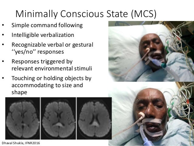 Coma Arousal Therapy - Waking Up From Minimally Conscious State