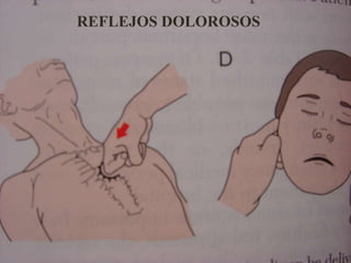REFLEJOS DOLOROSOS
 
