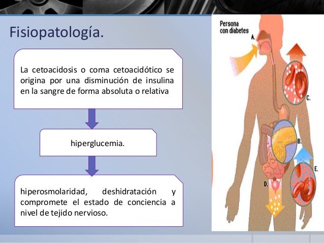 Coma diabetico