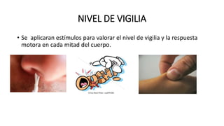 NIVEL DE VIGILIA
• Se aplicaran estímulos para valorar el nivel de vigilia y la respuesta
motora en cada mitad del cuerpo.
 