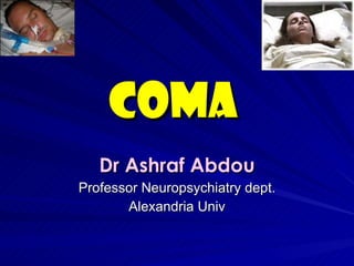 Coma   Dr Ashraf Abdou Professor Neuropsychiatry dept. Alexandria Univ 